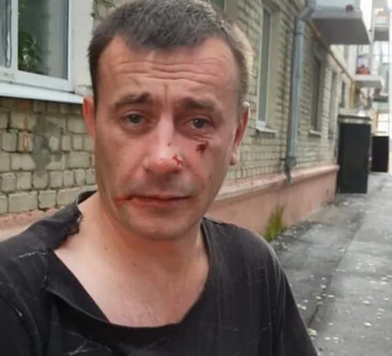 Избивший клинцовскую пенсионерку горожанин стал фигурантом уголовного дела